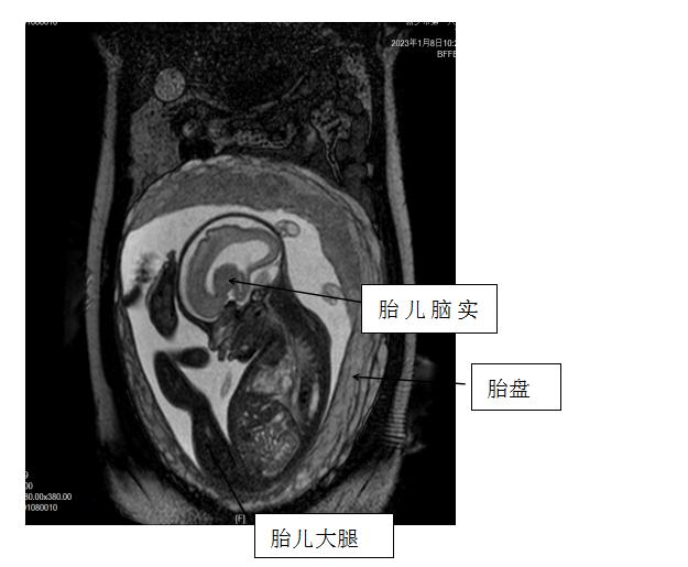 图片40.jpg